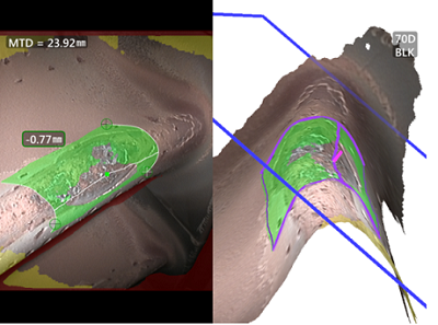 相位掃描三維立體測量圖 工業視頻內窺鏡相位掃描三維立體測量圖